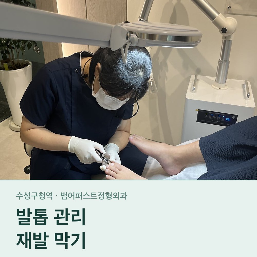 발톱 깎는 법과 신발 — 파고드는 발톱을 되돌리지 않으려면
