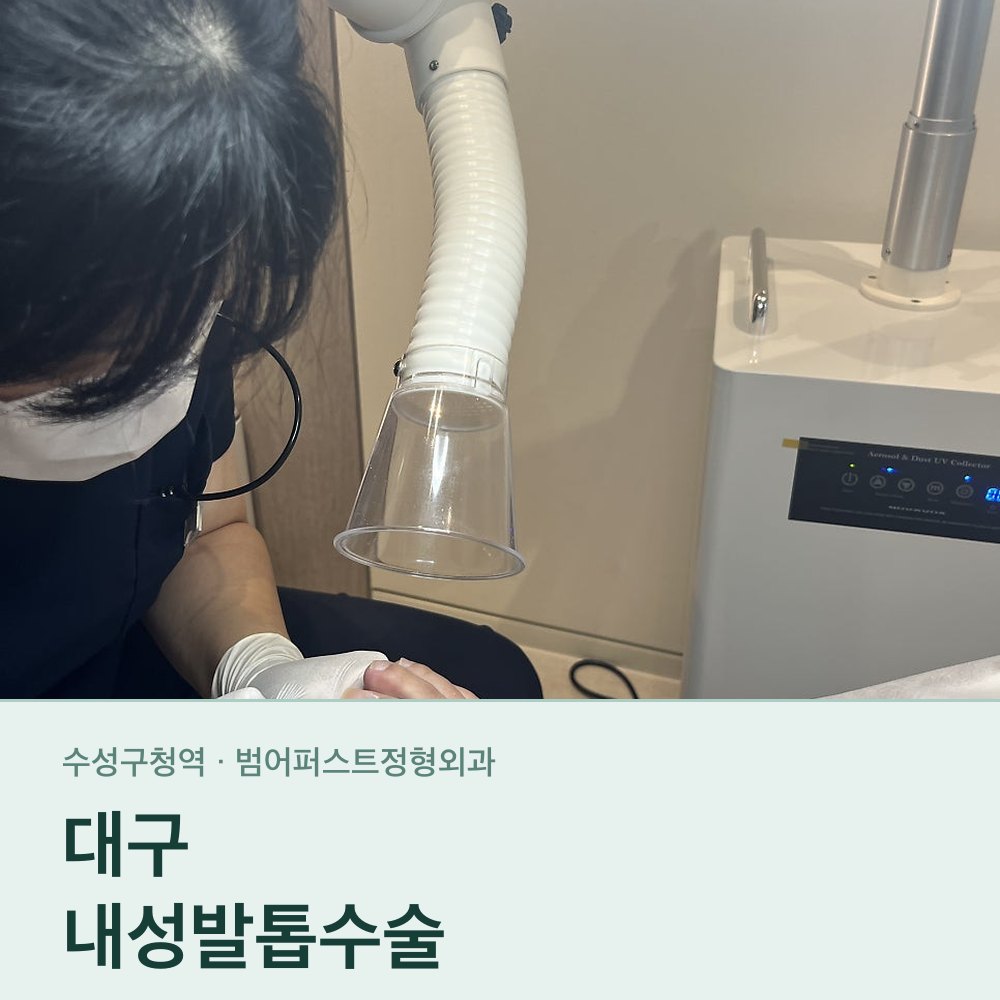대구내성발톱수술 — 교정과 수술, 어느 쪽을 먼저 보는가